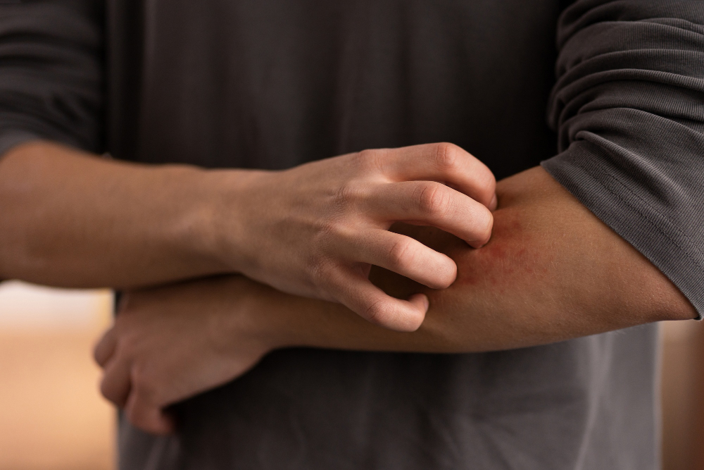 Understanding Lyme Disease: When to Seek Urgent Care