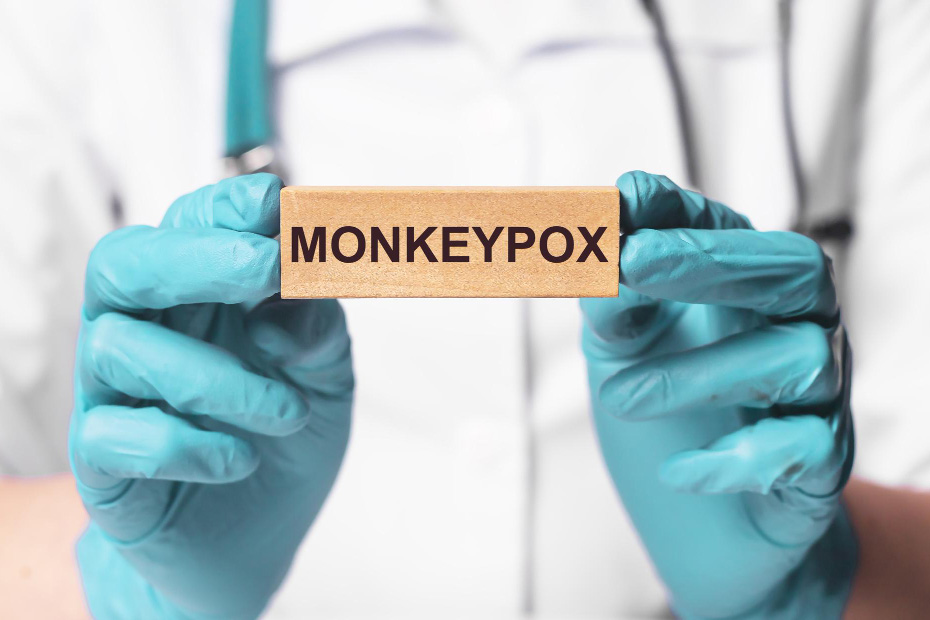 What You Need to Know About Monkeypox