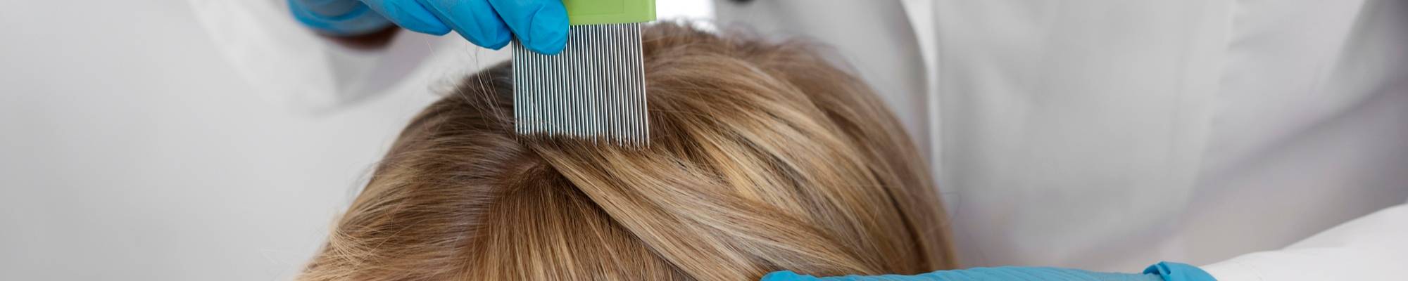 treatment for lice