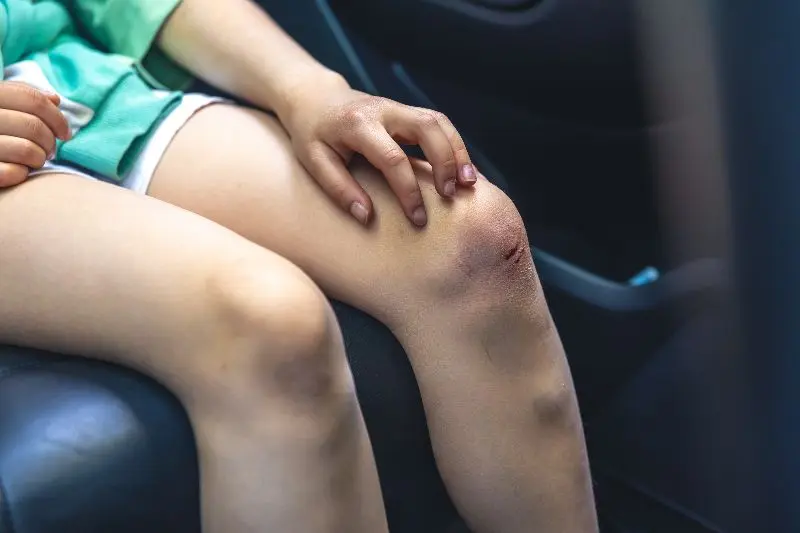 Knee cut & scrape