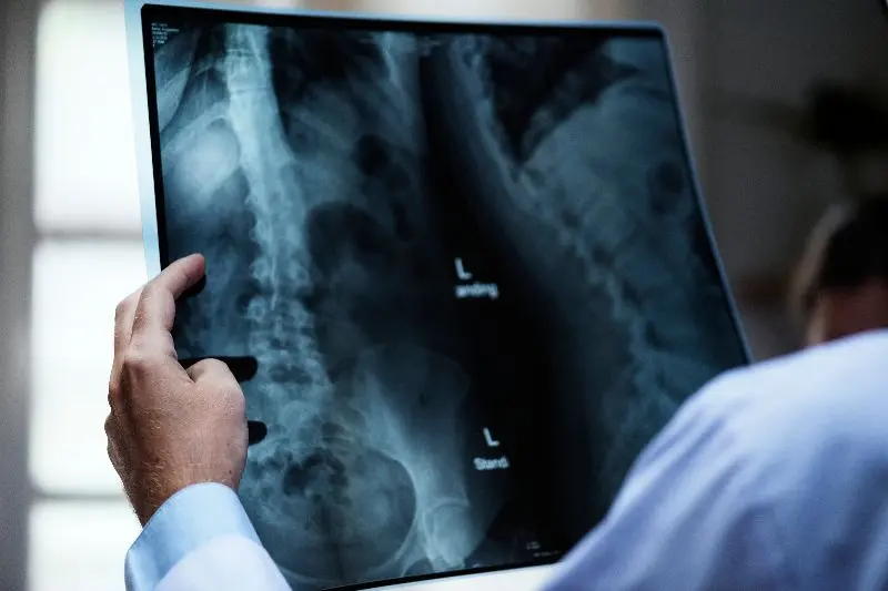 Doctor checking X-Ray results